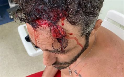 Ator Thiago Rodrigues Espancado Por Bandidos No Rio Veja Foto