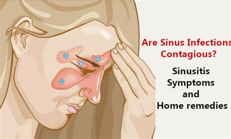 Are Sinus Infections Contagious? Sinusitis Symptoms and Home Remedies