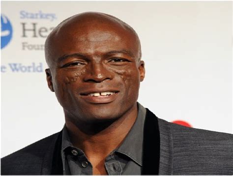 Seal - Cheeks & Face-12 Celebrities With Scars And Deformities | Seal singer, Singer, Famous ...