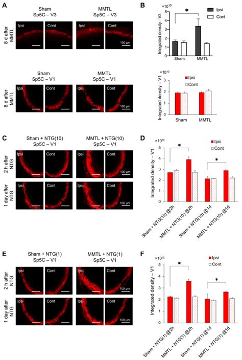 Effect Of Mmtl Pretreatment On The Protein Level Of Cgrp In The Sp C