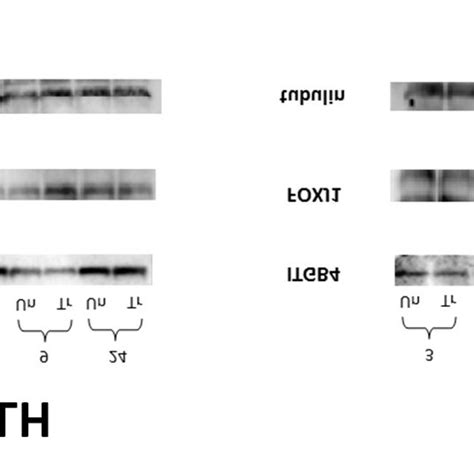 FOXJ1 And ITGB4 Expression At The Protein Level Relative Gene