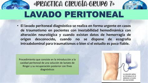 Lavado Peritoneal Med Estudios Udocz