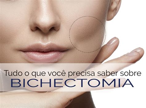 Tudo O Que Você Precisa Saber Sobre Bichectomia