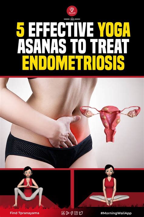 effective poses  yoga  endometriosis artofit