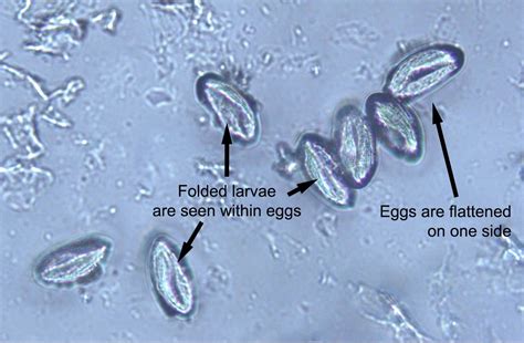 Enterobius Vermicularis Pinworm Eggs These Eggs Can Be Easily