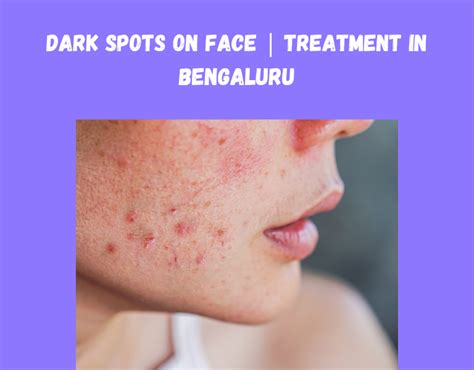 What Makes Clinic Next Face The Best Clinic In Jp Nagar