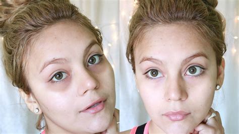 INCREÍBLE CÓMO ELIMINAR OJERAS EN DÍAS EFECTIVO Y NATURAL YouTube