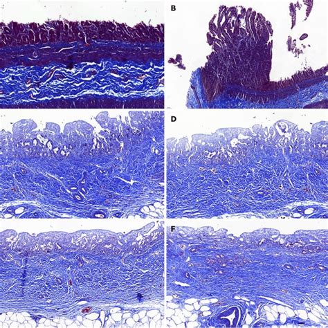 Masson S Trichrome Staining The Masson S Trichrome Staining Showed