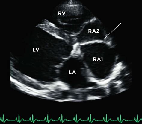 A Look At Unusual Congenital Heart Defects In Dogs And Cats