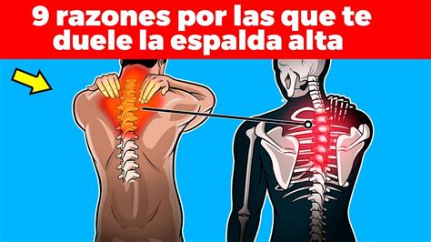 9 RAZONES POR LAS QUE TE DUELE LA ESPALDA ALTA YouTube