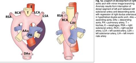 Diagram Of Development Of Right Aortic Arch With Mirror Image Download Scientific Diagram