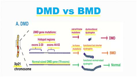 Difference Between Duchenne Muscular Dystrophy And Baker Muscular