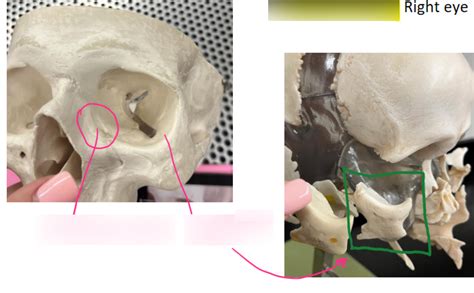 Bones Of The Orbit Anterior And Lateral Views Diagram Quizlet