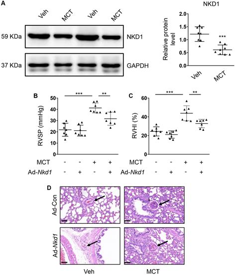 Naked Cuticle Homolog 1 Prevents Mouse Pulmonary Arterial Hypertension