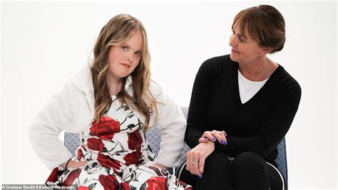 Model With Downs Syndrome Lands Contract With A Top Agency Daily