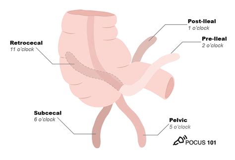 Appendix Measurement Ultrasound