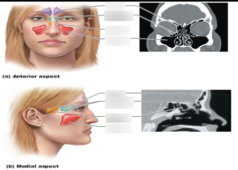 Sinuses Diagram Quizlet