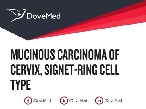 Mucinous Carcinoma Of Cervix Signet Ring Cell Type Dovemed