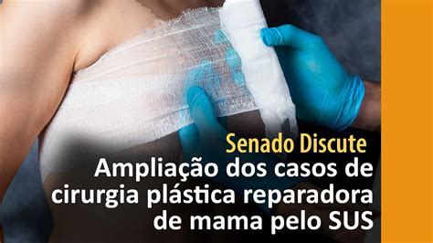 Cirurgia Para Diminuir A Mama Pelo Sus - Projeto amplia casos de cirurgia plástica reparadora de mama pelo SUS ...