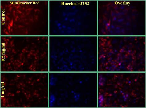 Effect Of Cuo Nps On Mitochondria Cells Were Stained With Mito