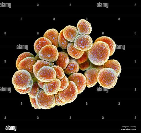 Mrsa Bacteria Coloured Scanning Electron Micrograph Sem Of