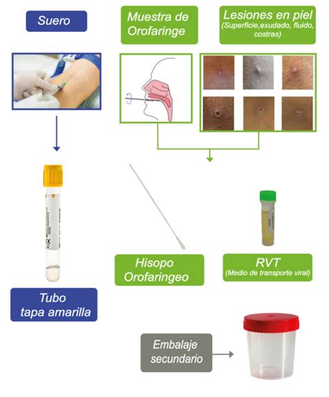 Toma De Muestra De Viruela S Mica Mdm Cient Fica