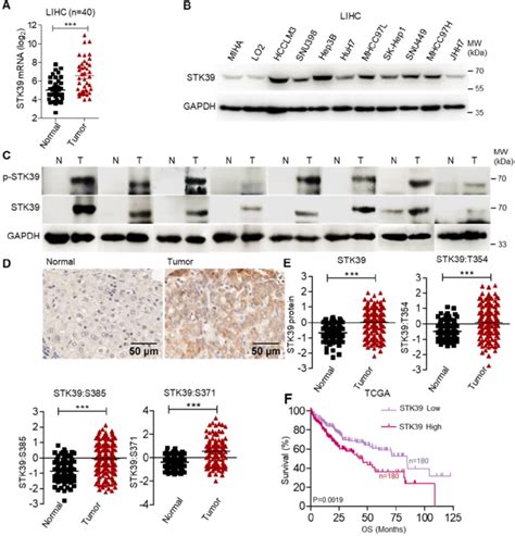 Stk39 Up Regulation In Hcc Tissues Is Regulated By Sp1 A The