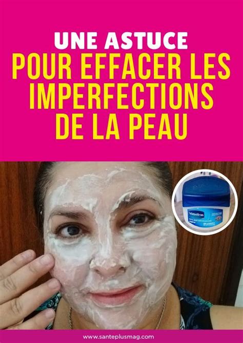 Une Astuce Pour Effacer Les Imperfections De La Peau Artofit