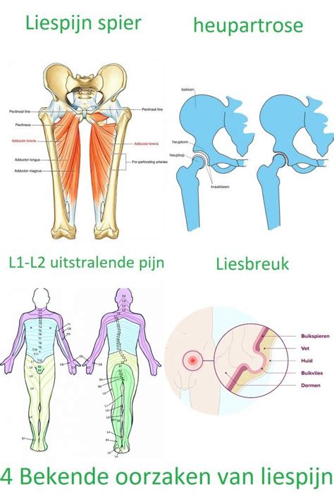 Behandel De Mogelijke Oorzaken Van Liespijn Met Oefeningen Om Je Rug