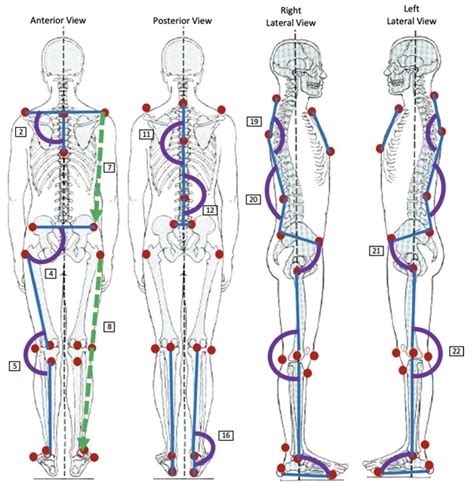 Bioengineering Free Full Text Posturall A Posture Assessment