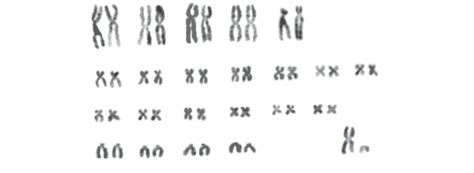 Karyotype Of Male M Arvalis F Arvalis From The Vicinity Of Botalovo