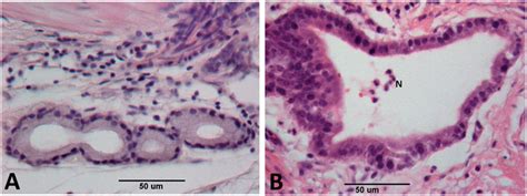 (A) Micrographs of H&E stained slides from sham and (B) injured ...