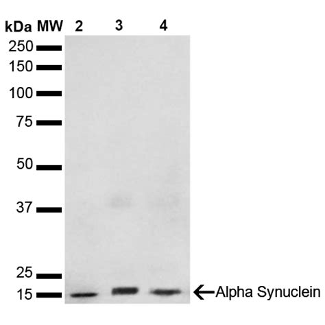 Anti Snca Alpha Synuclein Antibody Mouse Anti Human Monoclonal Lsbio