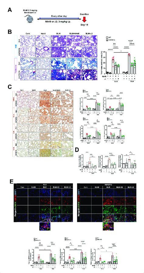 HSP27 Cross Linker NA49 Attenuates BLM Induced In PF NA49 And J2 3