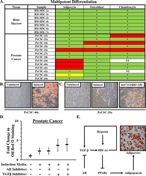 Multipotent Differentiation Of MSCs In Prostate Cancer A Multipotent