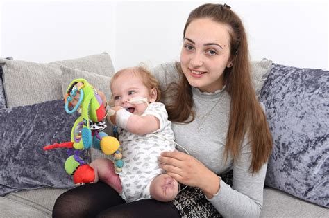 Infant Has All Four Limbs Amputated After Throat Infection Leads To Sepsis