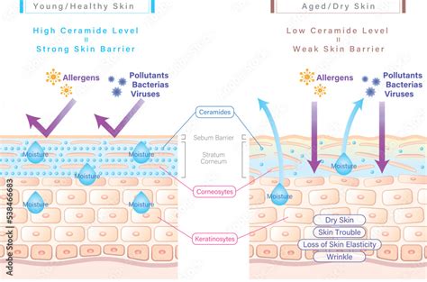 Vetor De Ceramide In Skin And Skin Barrier Illustration Comparing