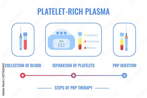 Prp Procedure Vector Infographic Test Tubes And Syringes Filled With