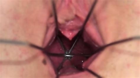 Gyno Gaping Of Beautiful Czech Babe