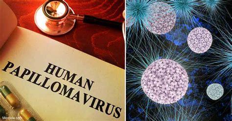 What Are the Types of HPV?