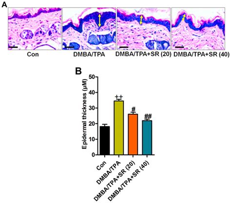 Salidroside Prevents Skin Carcinogenesis Induced By DMBA TPA In A Mouse