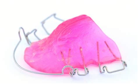 What Is A Hawley Retainer In Orthodontics Archwired