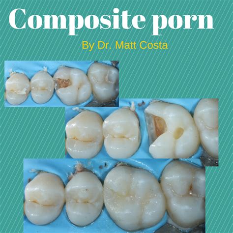 Composite Porn With Dr Art Volker Dr Steve Kuzmak And Dr Matt Costa