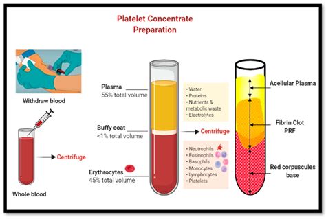 Dentistry Journal Free Full Text Alveolar Ridge Preservation With