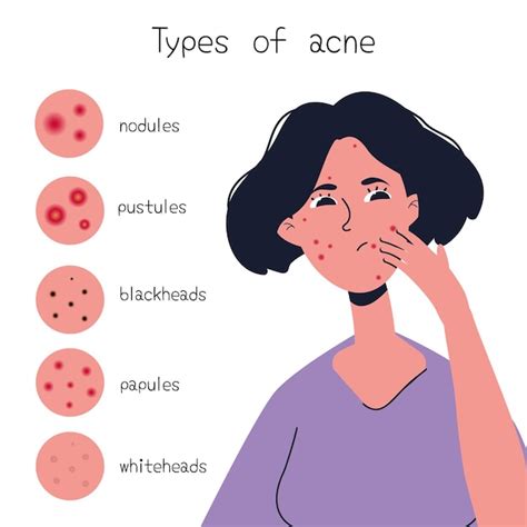 Premium Vector | Types of acne diagram