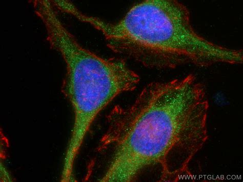 Gsdmd Antibody Ap Proteintech