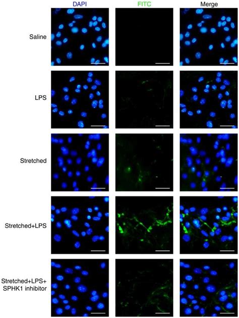 Effects Of Sphk Inhibitor On The Permeability Of Mouse Lung Vascular