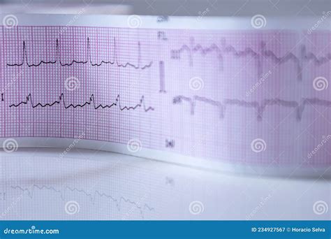 Ekg Graphelectrocardiogram Ekg Ecg With Red Blurred Heart Royalty Free