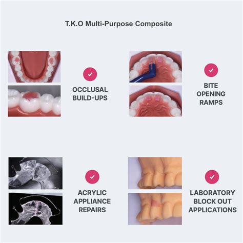 T.K.O.® Multi Purpose Light Cure Composite Pink Shade