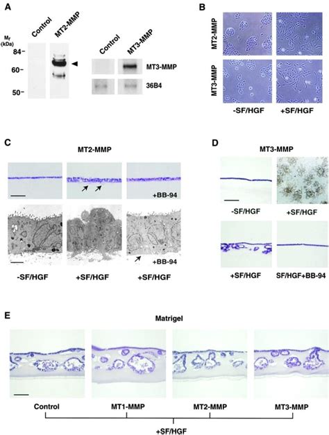 Characterization Of Mt2 Mmp And Mt3 Mmp Overexpressing Mdck Cells A